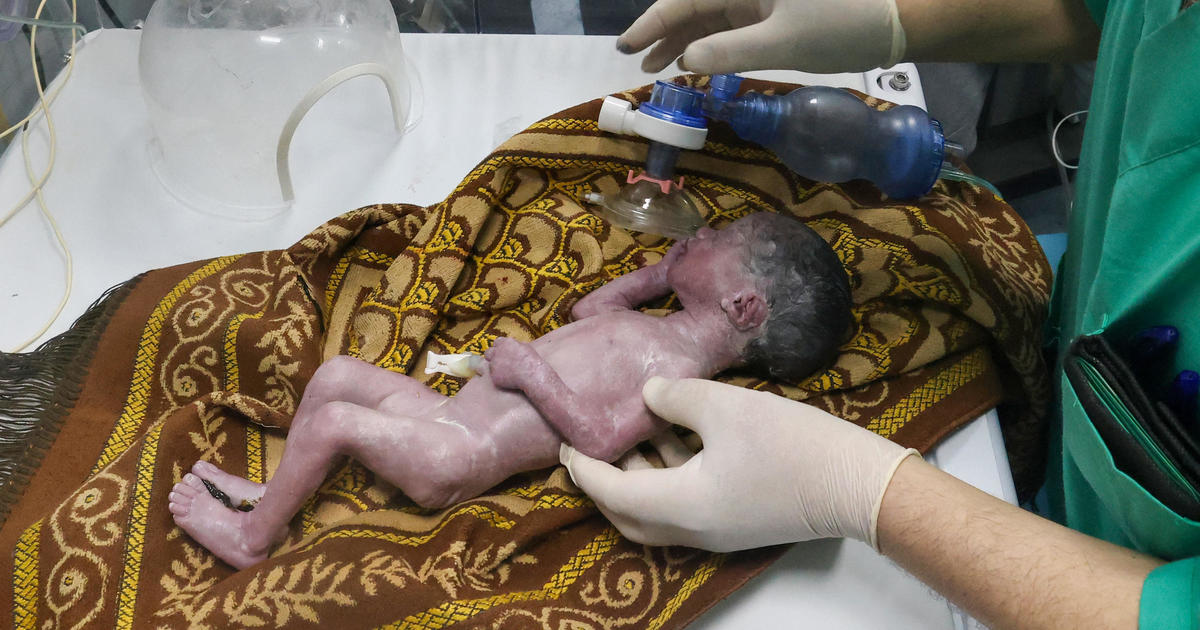 Baby saved from dying mother’s womb after Israeli airstrike on Gaza city of Rafah named in her honor [Video]